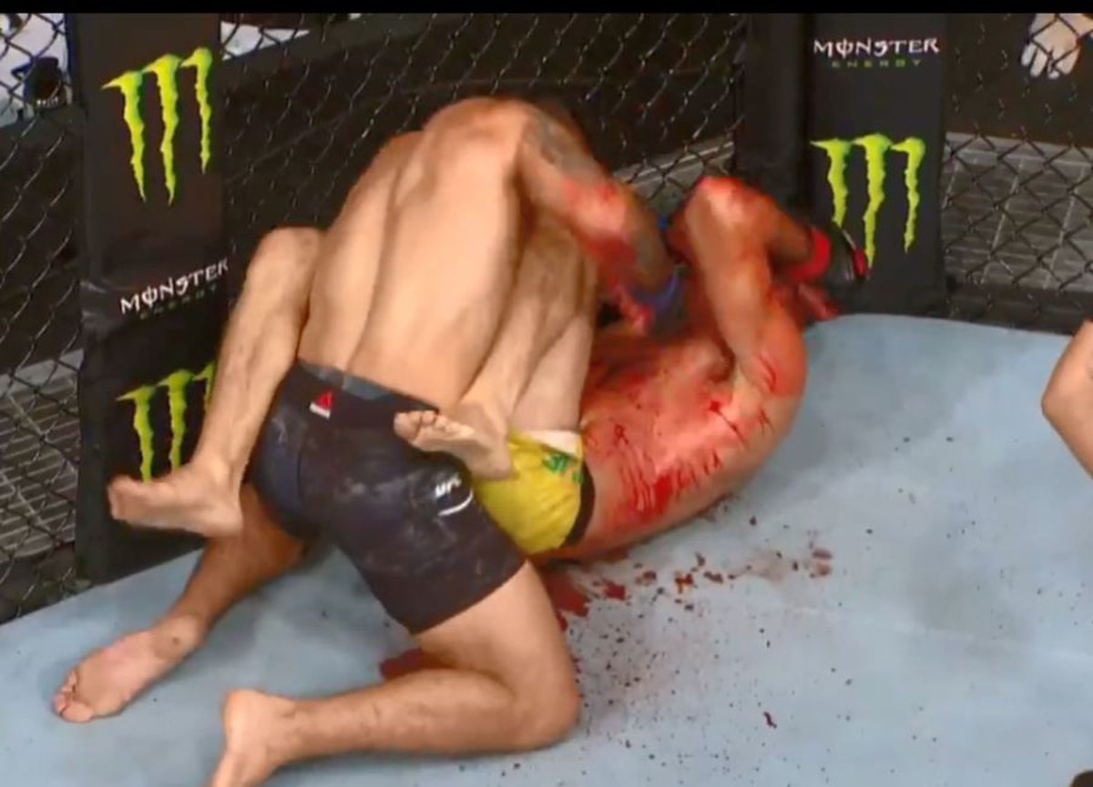 UFC URUGUAY // VIDEO+FOTO Imagini cu puternic impact emoțional! Mike Perry a terminat lupta cu nasul rupt