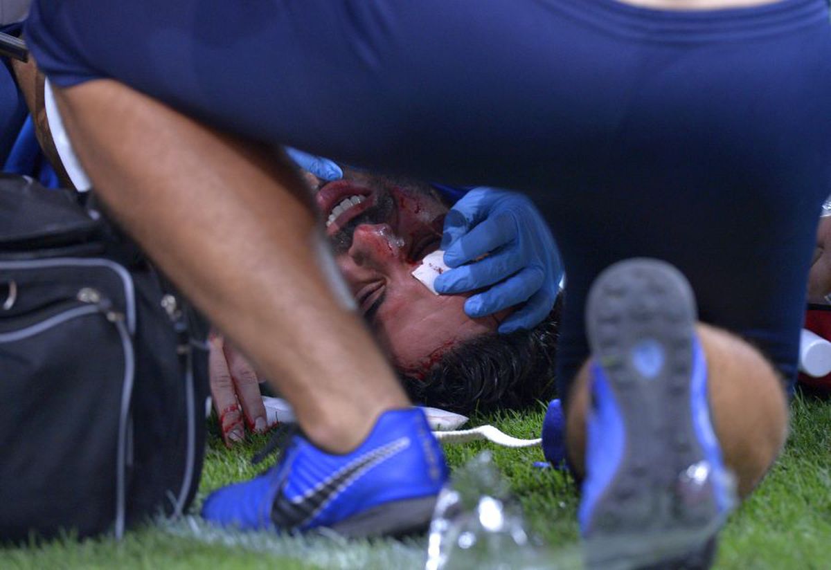 DINAMO - FC BOTOȘANI 1-1 // Atenție, imagini dure! Jucătorii au înmărmurit după ciocnirea horror dintre Moussa și Pap