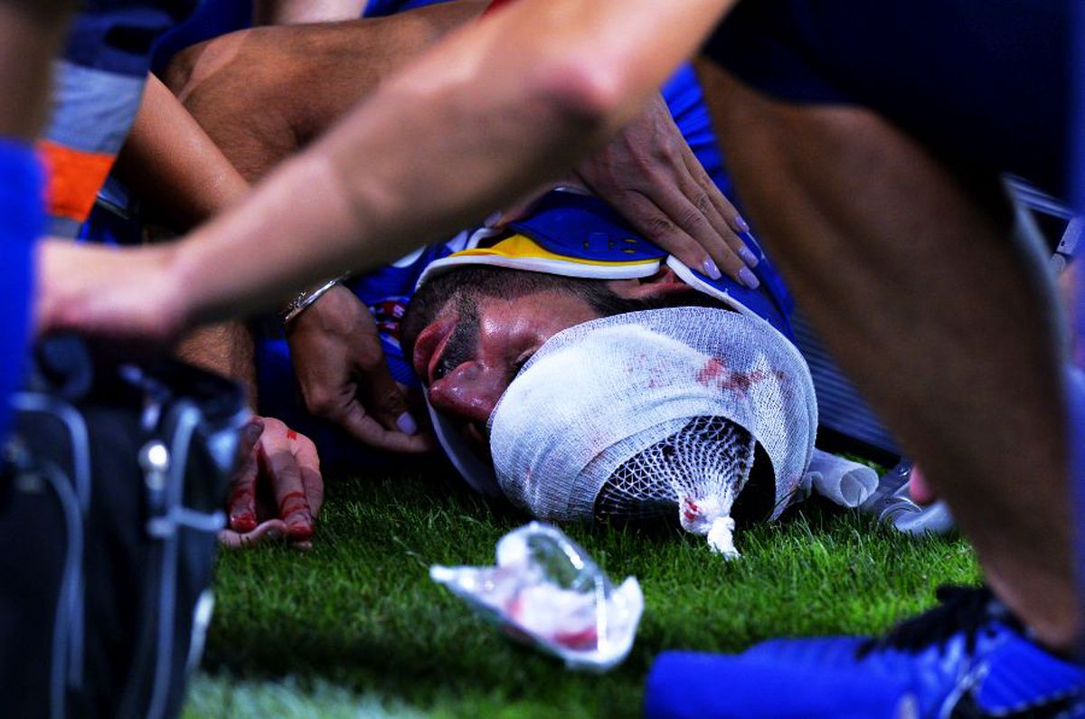 DINAMO - FC BOTOȘANI 1-1 // Atenție, imagini dure! Jucătorii au înmărmurit după ciocnirea horror dintre Moussa și Pap