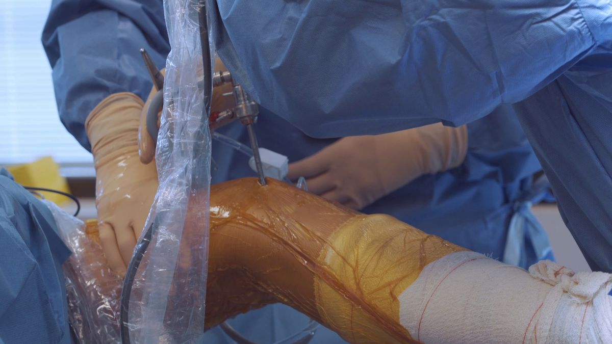 VIDEO // Cristina Neagu și-a lansat documentarul despre viața ei cu imagini cutremurătoare din sala de operație din Belgia: "Un 8 de neoprit!"