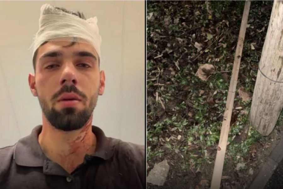 Victima Lucas Sperlea / FOTO: sursadevest.ro Șocant scandal! Doi fotbaliști de la Poli Timișoara, acuzați că au snopit în bătaie un tânăr de 19 ani: „Huliganii mi-au nenorocit copilul! Parul cu care l-au lovit e plin de sângele lui”