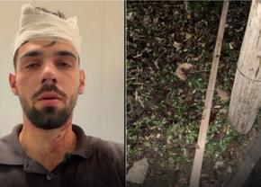 Șocant scandal! Doi fotbaliști de la Poli Timișoara, acuzați că au snopit în bătaie un tânăr de 19 ani: „Huliganii mi-au nenorocit copilul! Parul cu care l-au lovit e plin de sângele lui”