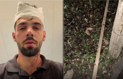 Șocant scandal! Doi fotbaliști de la Poli Timișoara, acuzați că au snopit în bătaie un tânăr de 19 ani: „Huliganii mi-au nenorocit copilul! Parul cu care l-au lovit e plin de sângele lui”