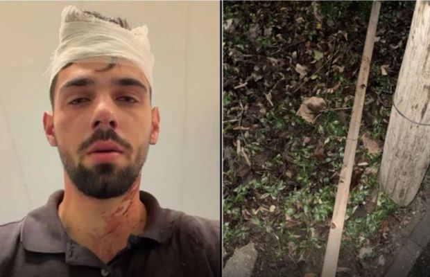 Șocant scandal! Doi fotbaliști de la Poli Timișoara, acuzați că au snopit în bătaie un tânăr de 19 ani: „Huliganii mi-au nenorocit copilul! Parul cu care l-au lovit e plin de sângele lui”