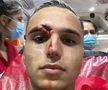 Desfigurat! FOTO-ȘOC din ambulanță: cum arată Cristi Manea, după faza care i-a îngrozit pe spectatorii din Gruia