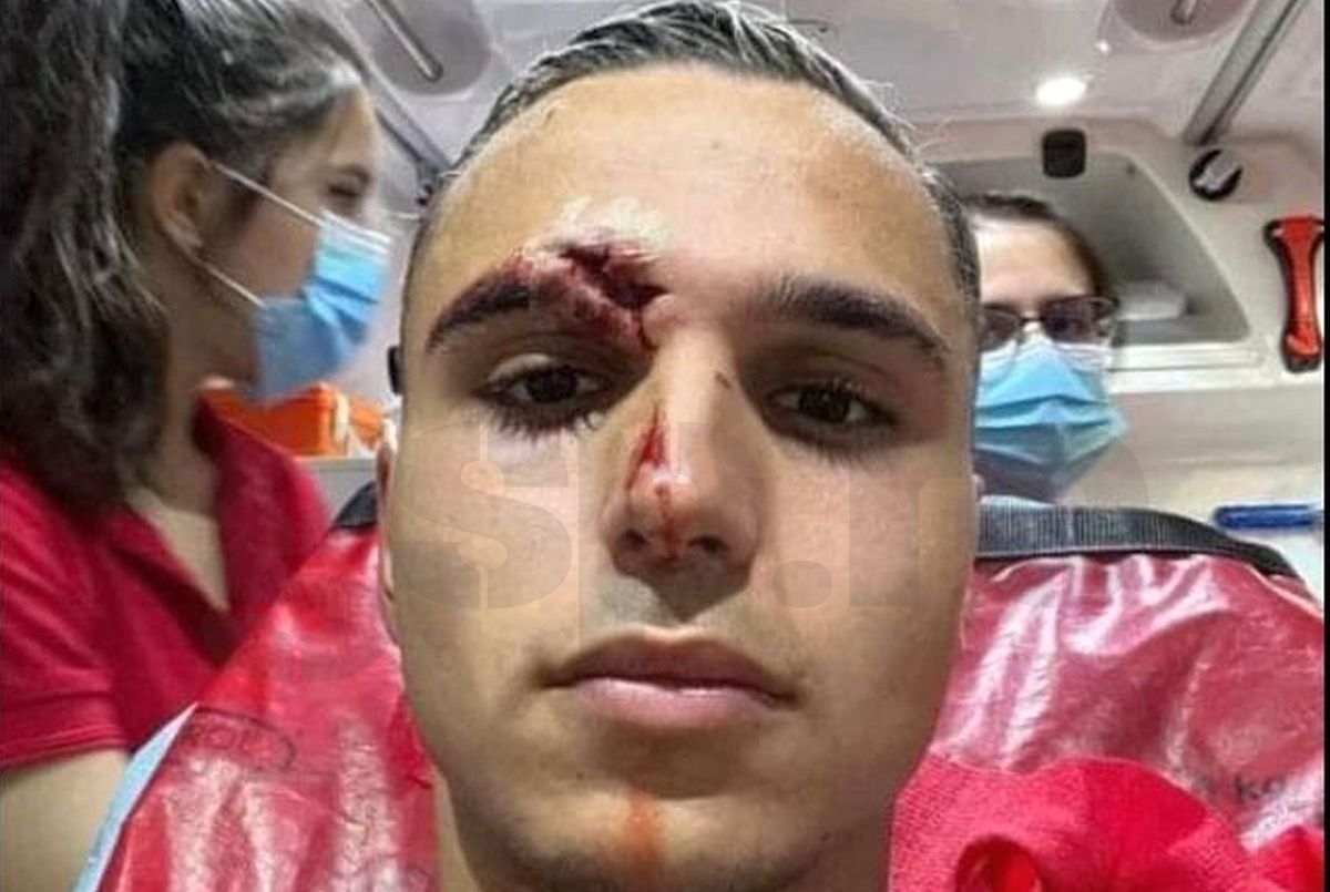 Desfigurat! FOTO-ȘOC din ambulanță: cum arată Cristi Manea, după faza care i-a îngrozit pe spectatorii din Gruia