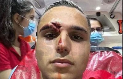 Desfigurat! FOTO-ȘOC din ambulanță: cum arată Cristi Manea, după faza care i-a îngrozit pe spectatorii din Gruia