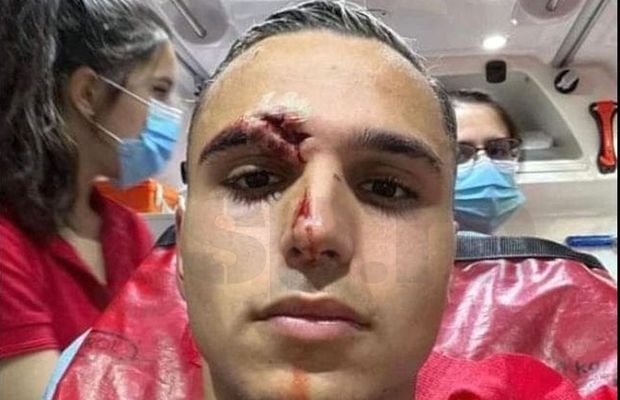 Desfigurat! FOTO-ȘOC din ambulanță: cum arată Cristi Manea, după faza care i-a îngrozit pe spectatorii din Gruia