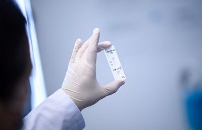 EXCLUSIV MTS confirmă pentru GSP că testele rapide vor fi aprobate la competițiile de amatori. „Modalitatea reduce costurile”