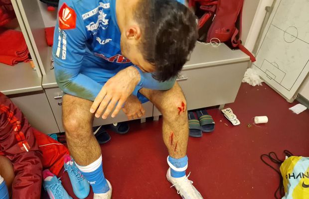 Cum arată jucătorii de la UTA după meciul cu CFR Cluj » Verdict în direct: „Trebuia dat penalty pentru arădeni”