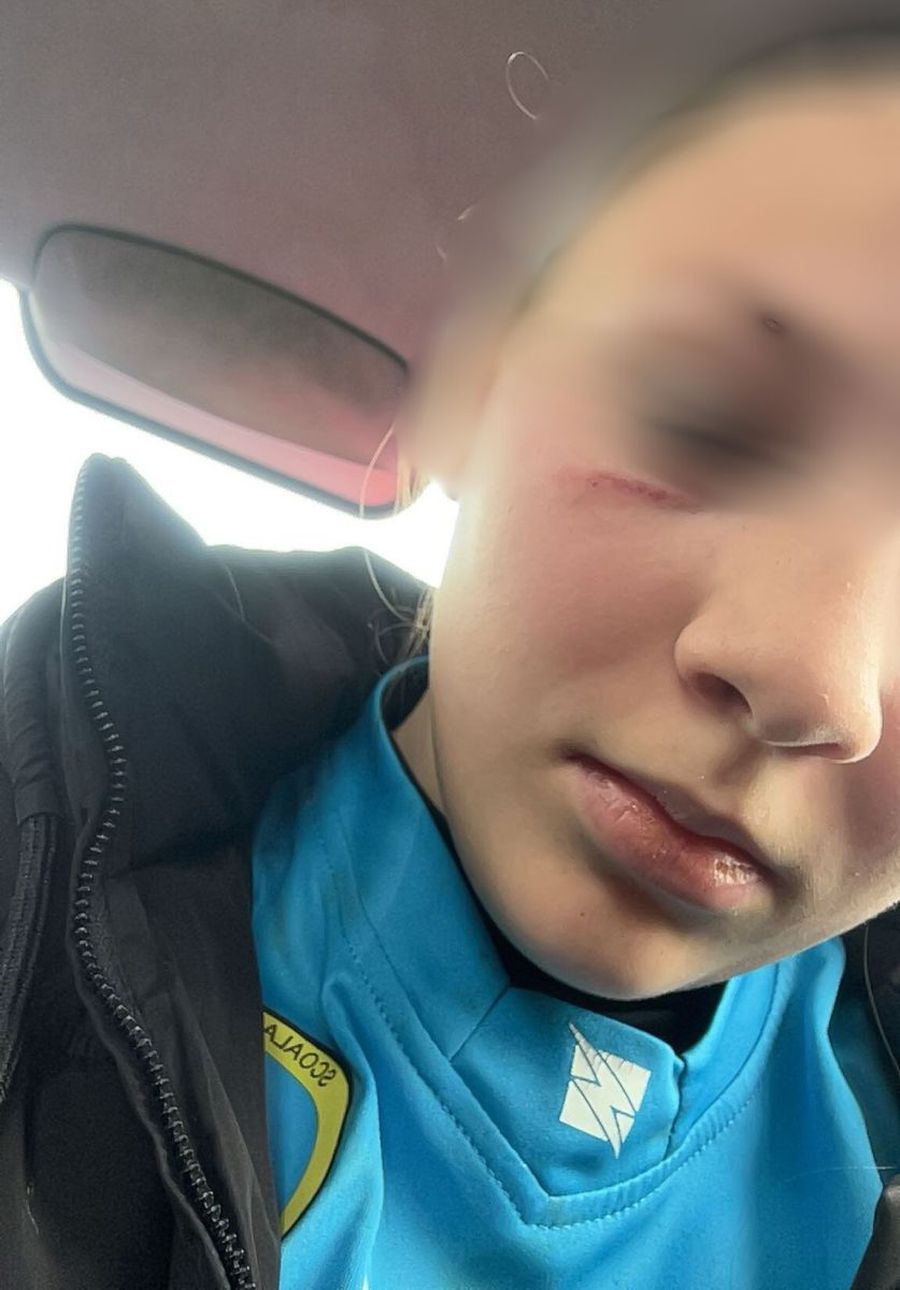 Fotbalista bătută/ foto: Sportul Sălăjan.ro Scene șocante la un meci de fotbal din România » O jucătoare în vârstă de 14 ani, bătută de mama unui adversar chiar pe teren