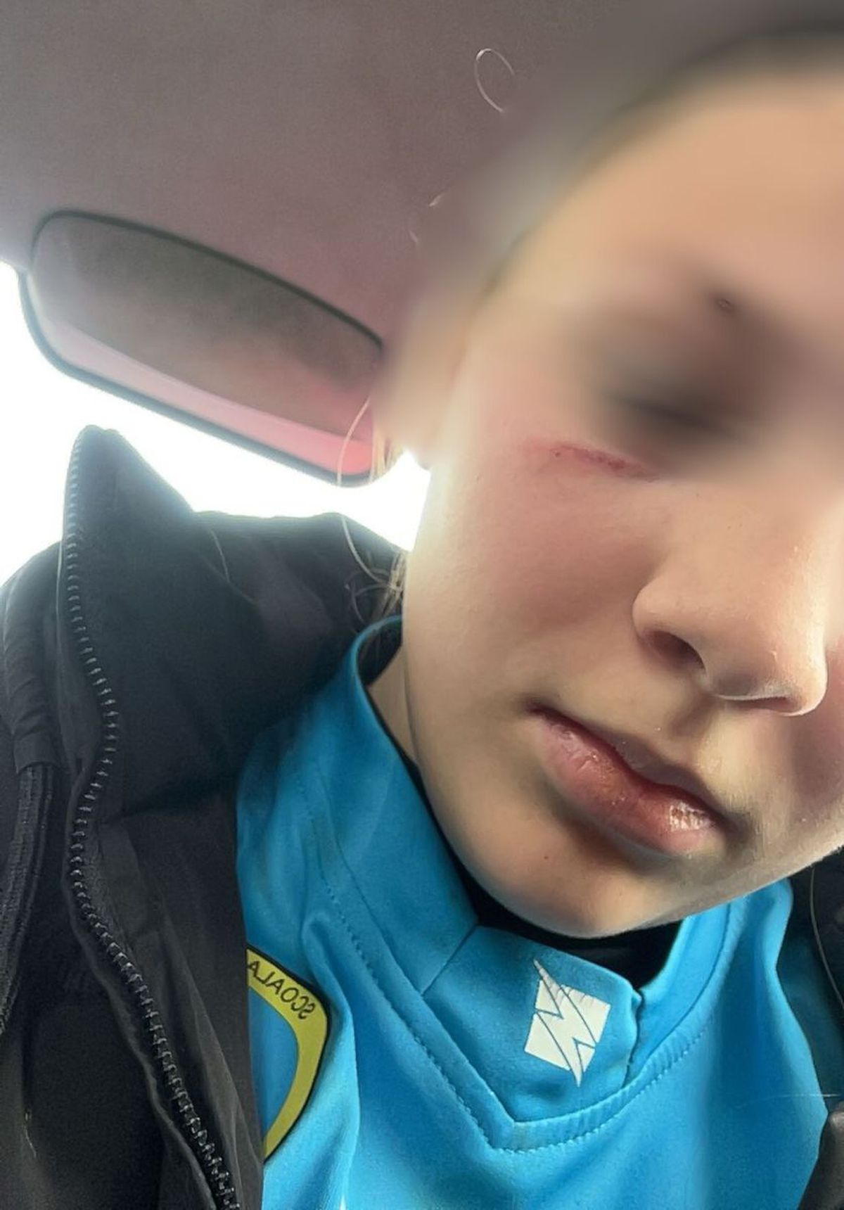 Fotbalistă de 14 ani lovită de mama unui jucător