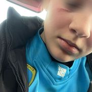 Fotbalista lovită/ Foto: Sportul Slăjan.ro