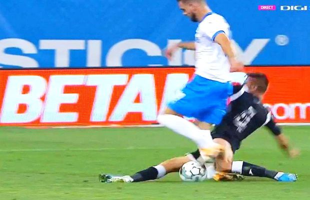 UPDATE VIDEO + FOTO Elvir Koljic, accidentare îngrozitoare în Craiova - Poli Iași! Cum arată radiografia jucătorului și care e diagnosticul