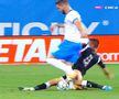 Elvir Kolic, golgeterul Craiovei, a suferit o accidentare gravă în minutul 35 al partidei cu Poli Iași.