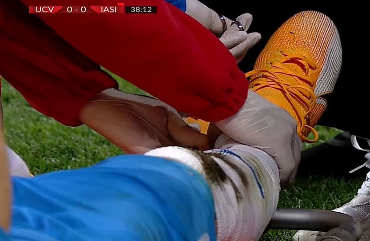 U CRAIOVA - POLI IAȘI 1-0. Daniel Pancu, prima reacție după înfrângerea contra Craiovei: „Mihalache nu a avut nicio intenție! Hațegan a sancționat consecințele”