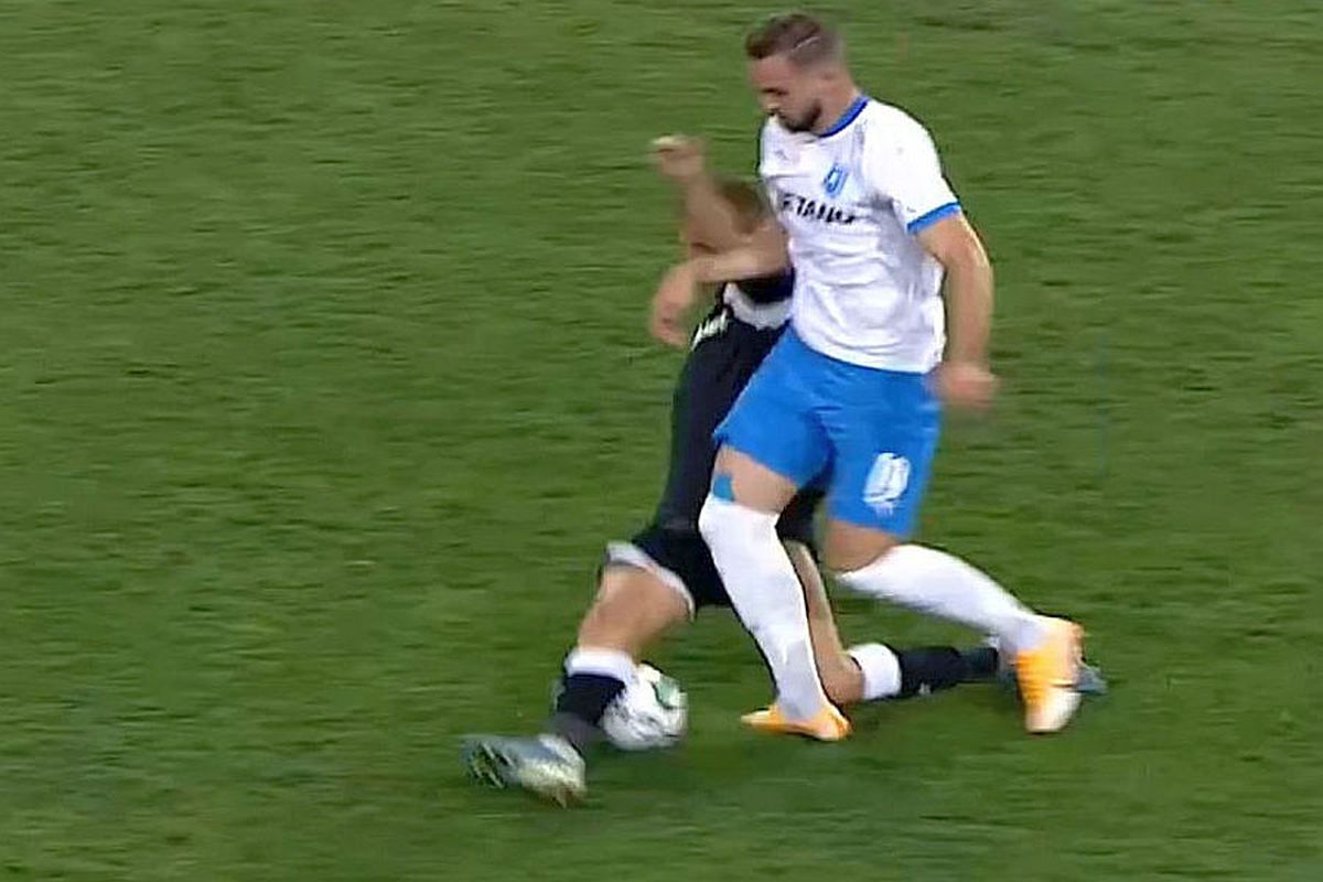 FOTO Ce înseamnă o fractură de gleznă! Două cazuri asemănătoare în Liga 1+ ce spun doctorii: „Se resimte și după 20-25 de ani”