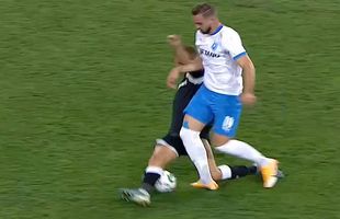 FOTO Ce înseamnă o fractură de gleznă! Două cazuri asemănătoare în Liga 1+ ce spun doctorii: „Se resimte și după 20-25 de ani”