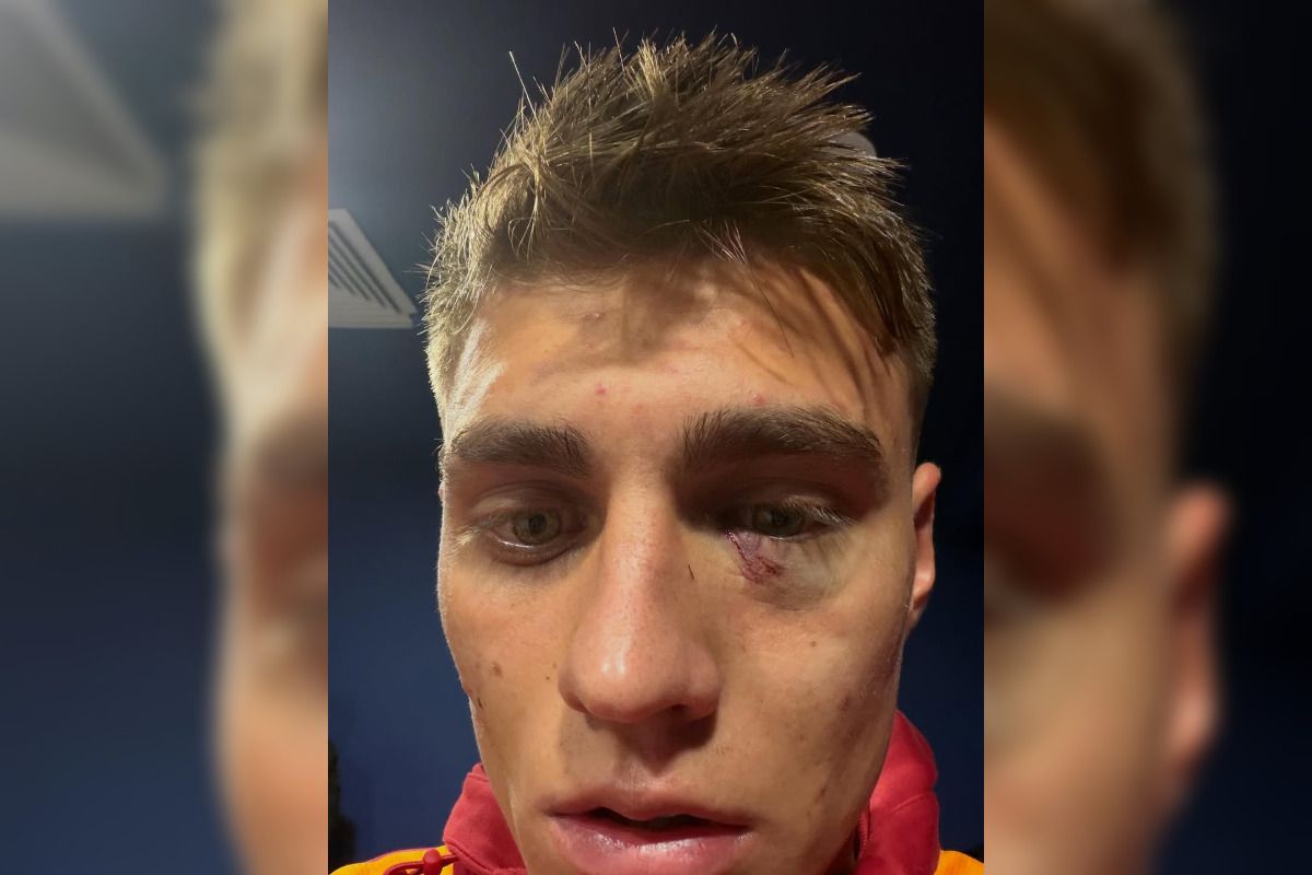 Scandal „bricheta” în Fenerbahce - Galatasaray! Lovit imediat după gol, sub privirile lui Lucescu