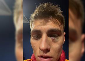 Scandal „bricheta” în Fenerbahce - Galatasaray! Lovit imediat după gol, sub privirile lui Lucescu