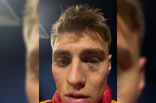 Scandal „bricheta” în Fenerbahce - Galatasaray! Lovit imediat după gol, sub privirile lui Lucescu