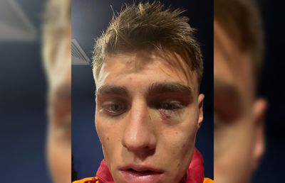 Scandal „bricheta” în Fenerbahce - Galatasaray! Lovit imediat după gol, sub privirile lui Lucescu