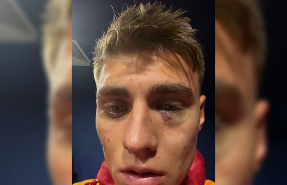 Scandal „bricheta” în Fenerbahce - Galatasaray! Lovit imediat după gol, sub privirile lui Lucescu