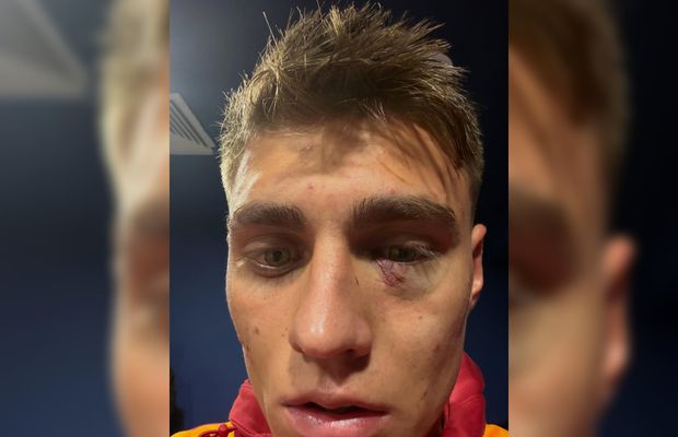 Scandal „bricheta” în Fenerbahce - Galatasaray! Lovit imediat după gol, sub privirile lui Lucescu