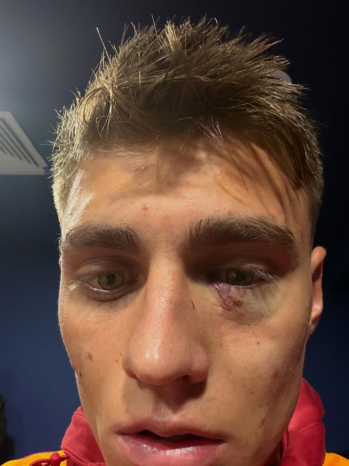 Scandal „bricheta” în Fenerbahce - Galatasaray! Lovit imediat după gol, sub privirile lui Lucescu