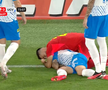 Valentin Crețu, alături de Alexandru Mitriță după ce l-a lovit, involuntar, cu mingea în față