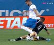 U CRAIOVA - POLI IAȘI 1-0 // UPDATE Unde și când se operează Elvir Koljic, după accidentarea gravă suferită aseară