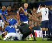 EVERTON - TOTTENHAM 1-1 // FOTO Cumplita suferință a lui André Gomes povestită de un coleg: „Avea ochii ieșiți din orbite. Plângea, striga, urla”. Va fi operat azi!