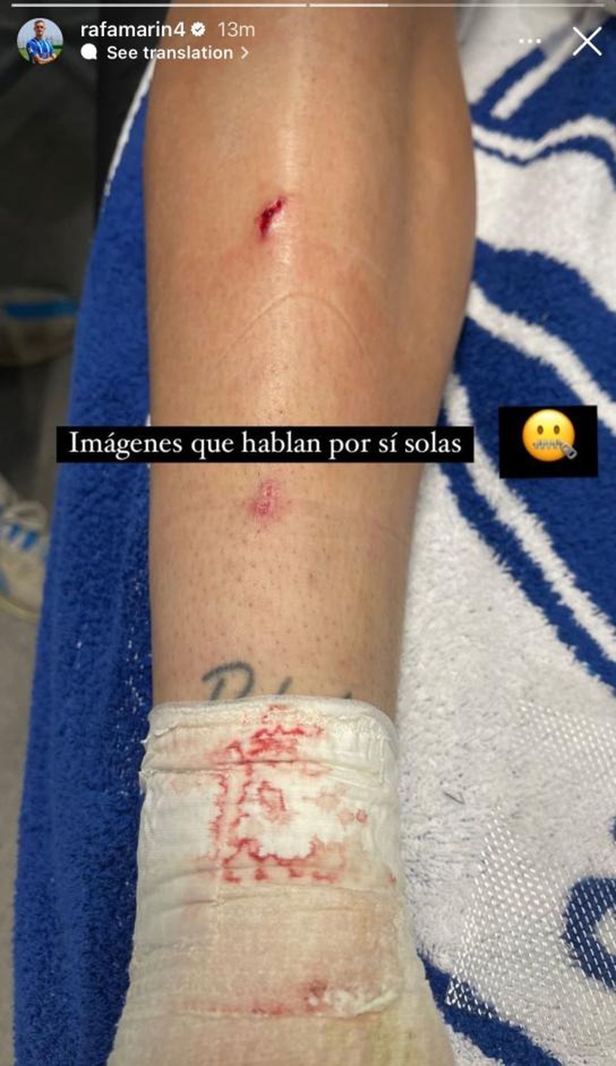 „Imaginile vorbesc de la sine” » Fotbalistul lui Deportivo Alaves e acuzat că minte, după eliminarea din Alaves - Barcelona