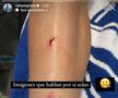 Rafa Marin a postat imagini cu ceea ce spune că ar fi urmele faultului lui Vitor Roque