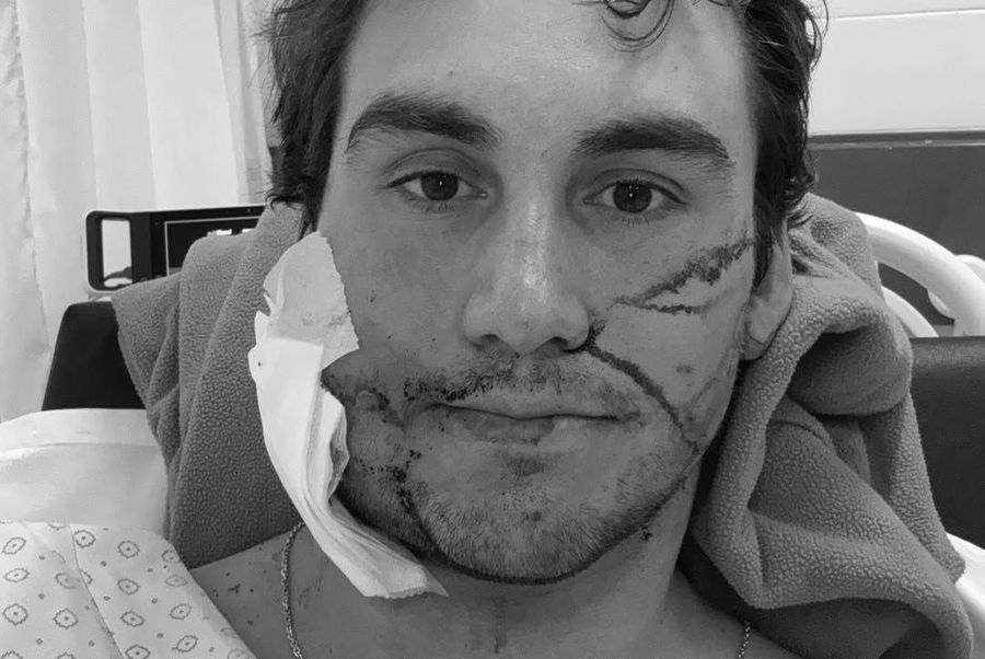 Sezon încheiat pentru un schior de elită » Transportat cu elicopterul și operat de urgență