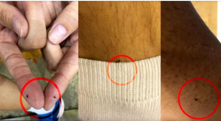 Sportivii ajunseseră să se plângă constant de mușcăturile puricilor