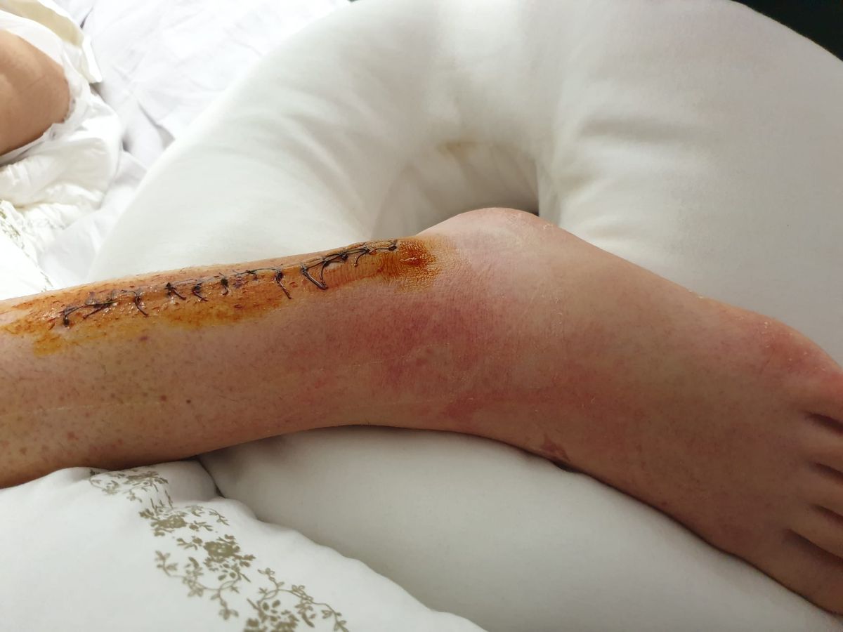 Și-a făcut arc din oase frânte! Povestea INCREDIBILĂ a Andei: „Eram studentă, un copac a căzut peste mine pe stradă” » A transformat ghinionul în vis olimpic: „Dacă eu pot, pot și ceilalți. Fără scuze!”