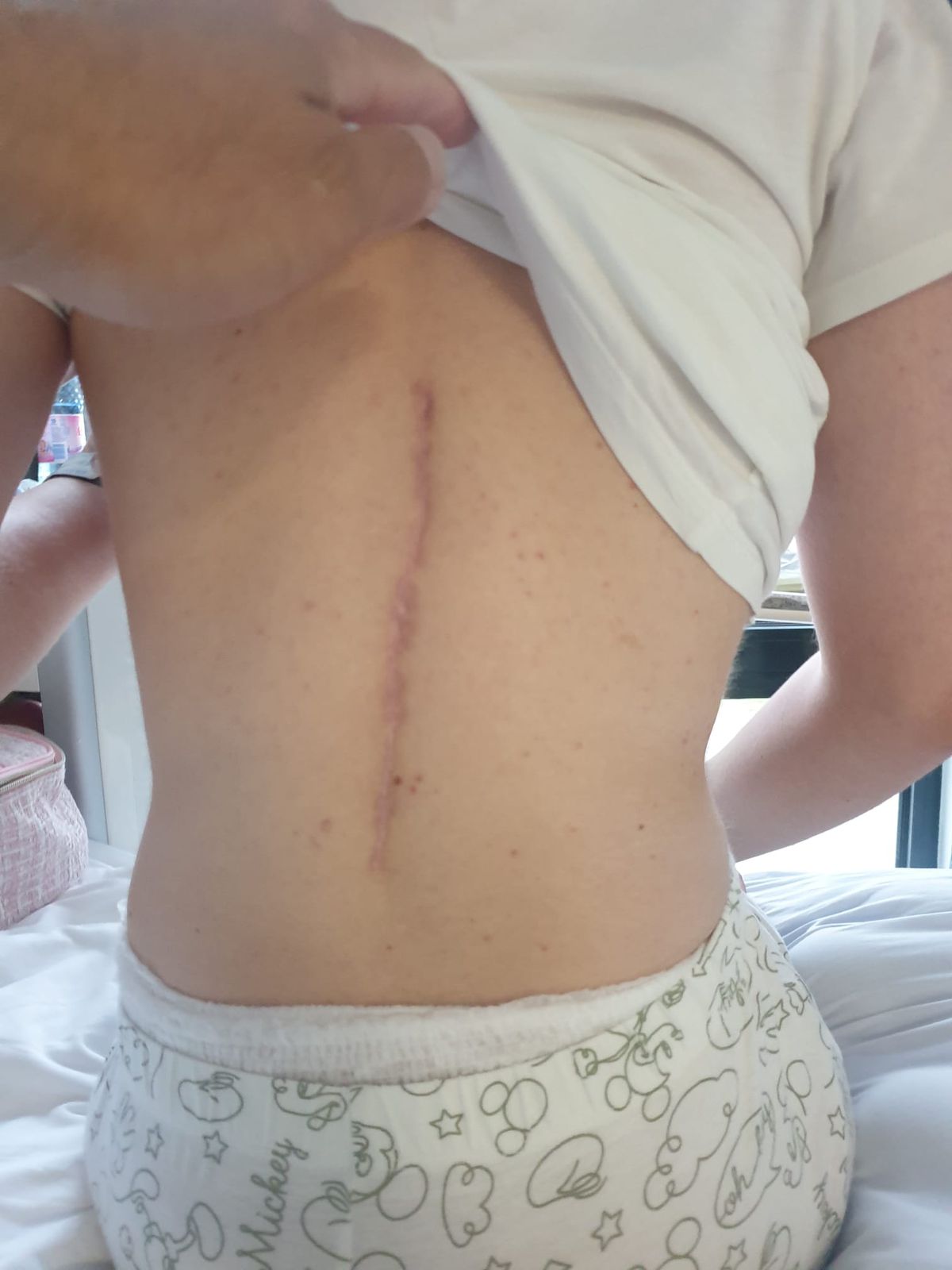 Și-a făcut arc din oase frânte! Povestea INCREDIBILĂ a Andei: „Eram studentă, un copac a căzut peste mine pe stradă” » A transformat ghinionul în vis olimpic: „Dacă eu pot, pot și ceilalți. Fără scuze!”