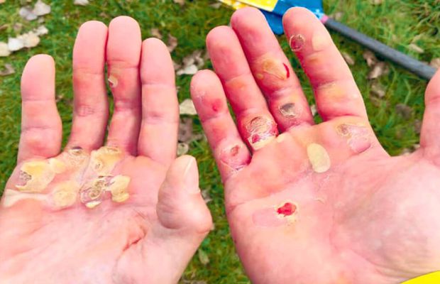 EXCLUSIV Pălmașii apelor și visurile lor care dor » Doi canotori din lotul României oferă imaginea începutului de an în sport