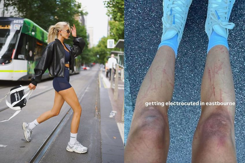 Morgan Riddle și-a expus pe Instagram picioarele pline de răni