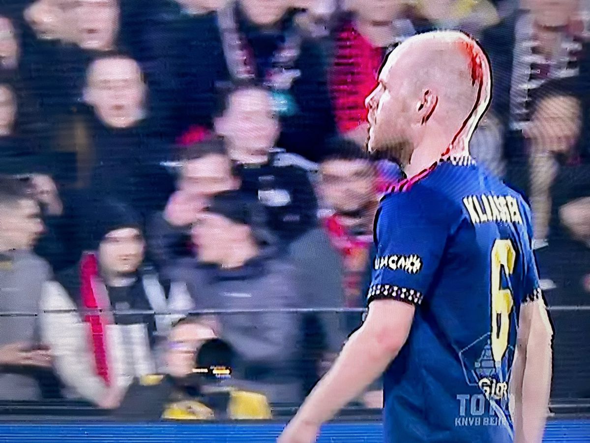 FOTO Feyenoord - Ajax, incidente 05.04.2023