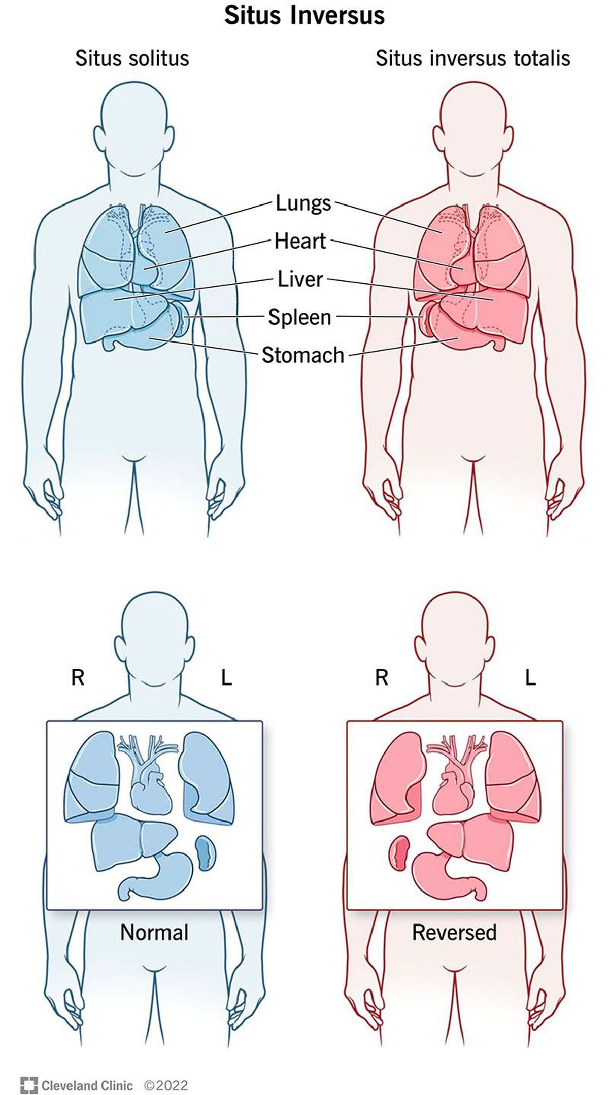 „Trăiesc o altă viață!” » Gazeta l-a găsit pe fotbalistul român cu inima în partea dreaptă, ex-„tricolor”: „Cazul meu a fost nemaivăzut, nemaiauzit! Sunt printre norocoși, dar mi-a dăunat în relația cu Grigoraș”