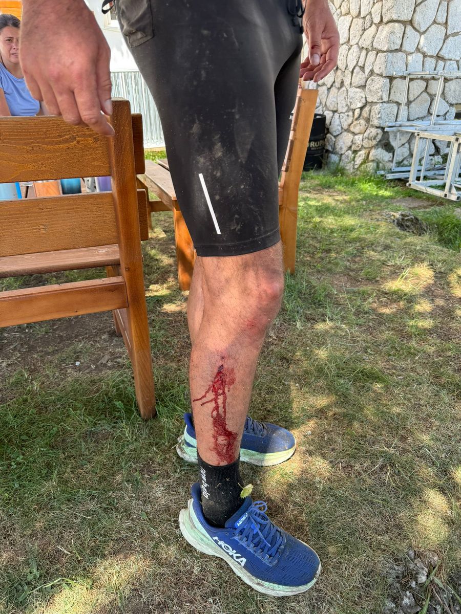 Călin Laza, atacat brutal de 8 câini/Foto: Bihoreanul „Nu aș fi avut nicio șansă de supraviețuire” » Situație dramatică pentru un antrenor de atletism: a fost atacat brutal de 8 câini