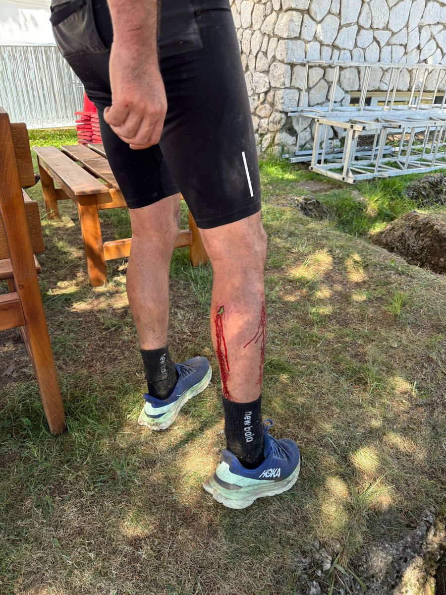 Călin Laza, atacat brutal de 8 câini/Foto: Bihoreanul „Nu aș fi avut nicio șansă de supraviețuire” » Situație dramatică pentru un antrenor de atletism: a fost atacat brutal de 8 câini