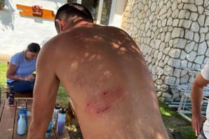 „Nu aș fi avut nicio șansă de supraviețuire” » Situație dramatică pentru un antrenor de atletism: a fost atacat brutal de 8 câini