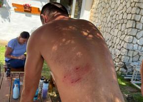 „Nu aș fi avut nicio șansă de supraviețuire” » Situație dramatică pentru un antrenor de atletism: a fost atacat brutal de 8 câini