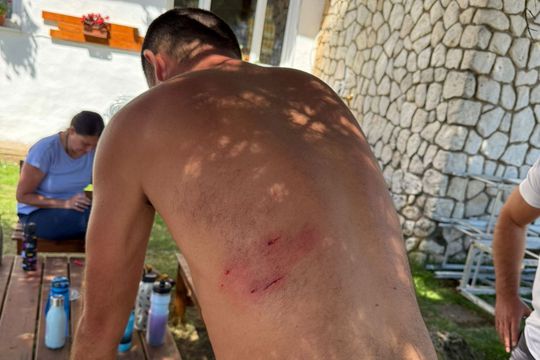 Călin Laza, atacat de 8 câini pe un traseu montan/Foto: Bihoreanul