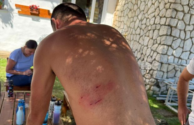 „Nu aș fi avut nicio șansă de supraviețuire” » Situație dramatică pentru un antrenor de atletism: a fost atacat brutal de 8 câini