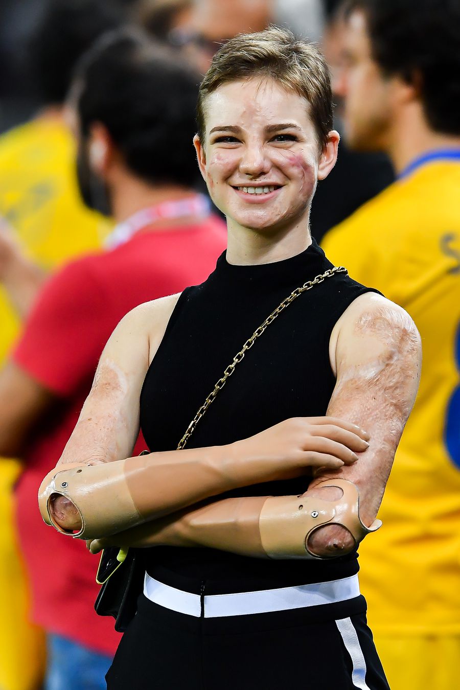 Bebe Vio, sportiva care nu știe ce înseamnă «imposibil». Fran Kirby și sfatul pentru cei care suferă de depresie + AS Roma, surpriză pentru un fan special