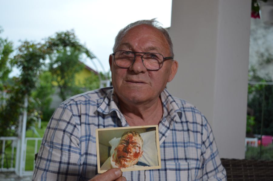 Povestea cutremurătoare a unui român care a șocat Mondialul: „Fața mea a fost pe post de frână, durerea nu poate fi descrisă”. Ce a urmat e de neimaginat: „Doctorul a cerut urgent o poză cu mine”